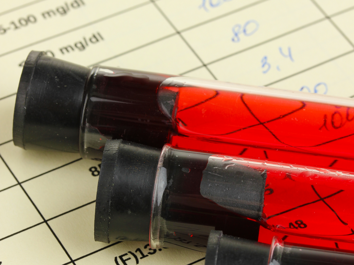 > 60 Lab Collected Biomarkers Expertly Analyzed